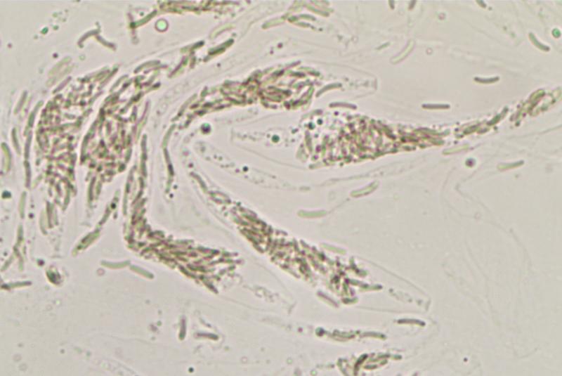 macrostoma