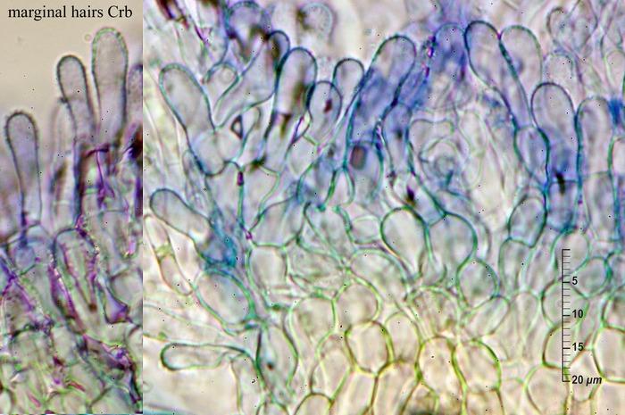 macrostoma