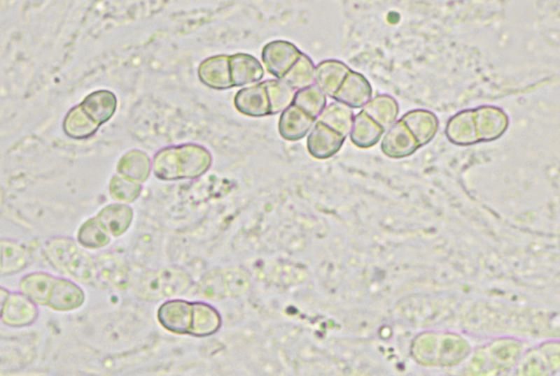 macrostoma