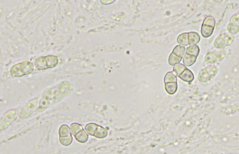 macrostoma