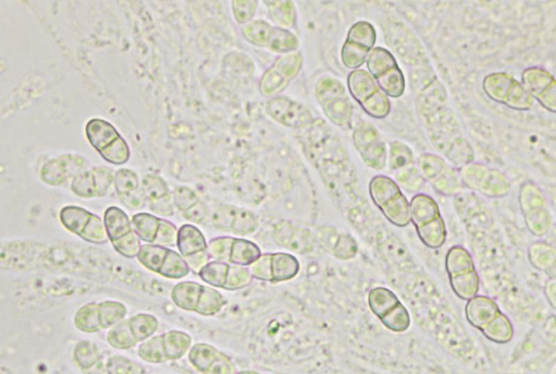 macrostoma
