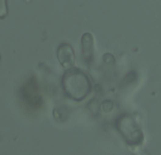 macrostoma