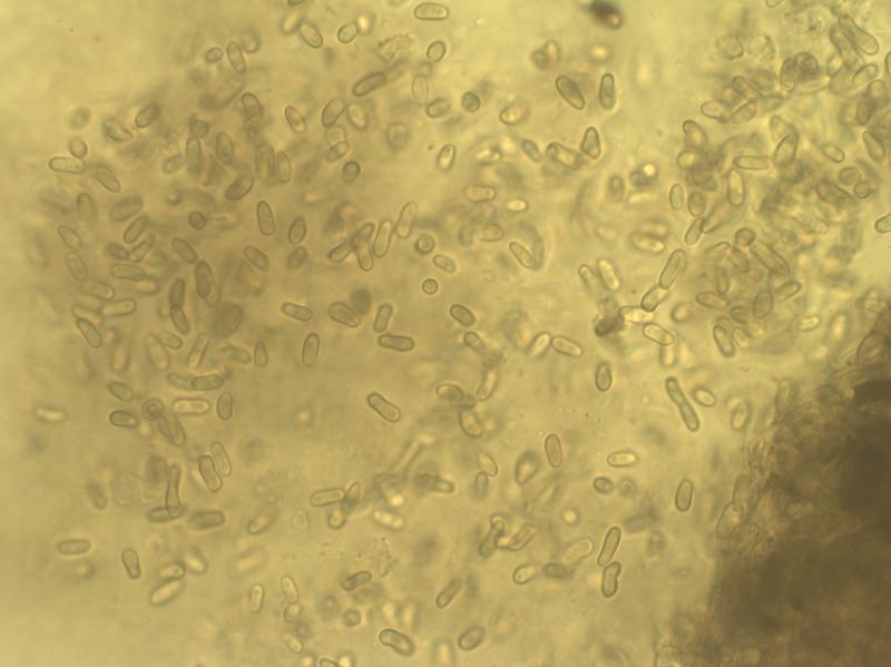 macrostoma