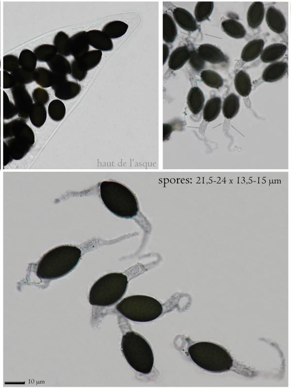 macrostoma