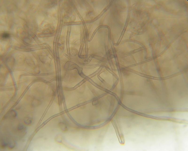 macrostoma