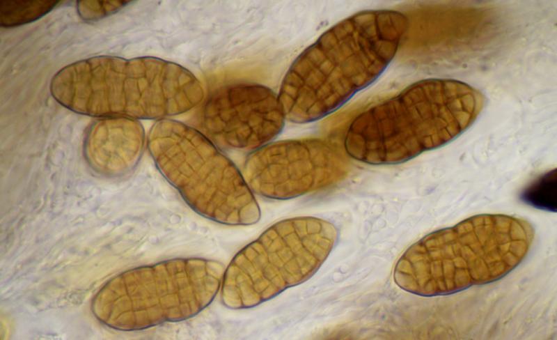 macrostoma