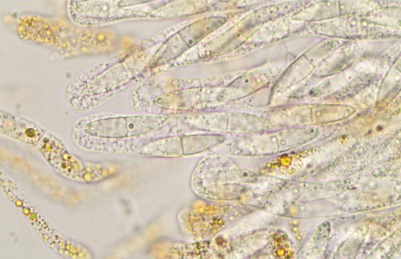 macrostoma