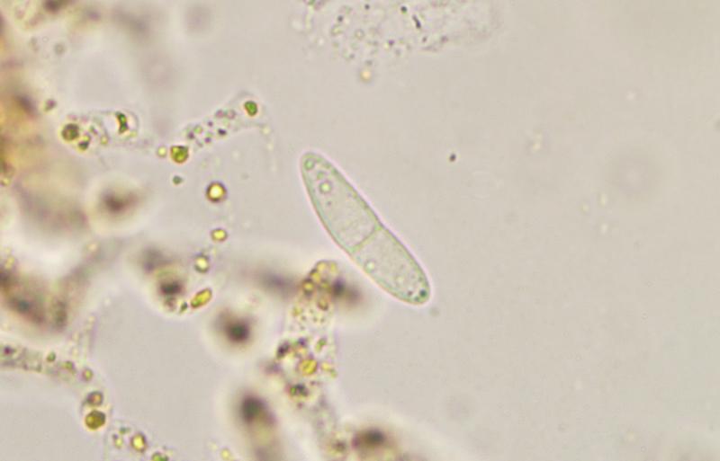 macrostoma