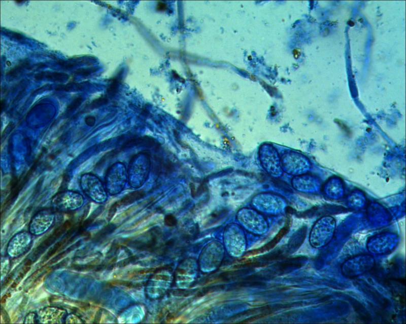 macrostoma