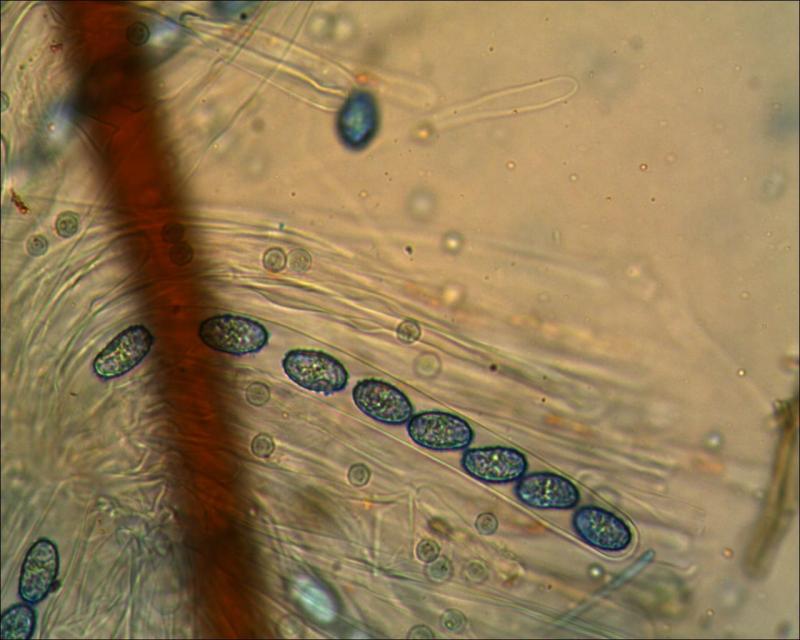 macrostoma