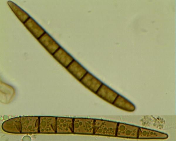 macrostoma