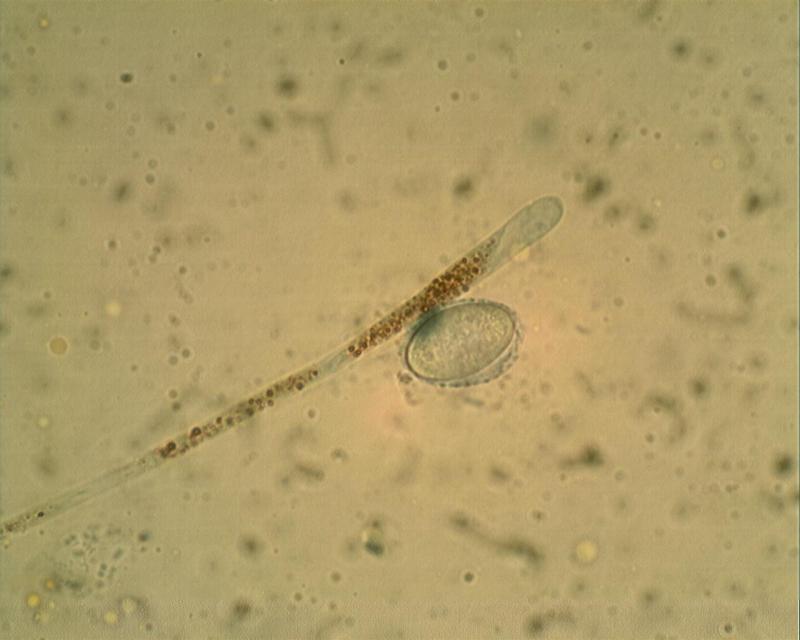 macrostoma
