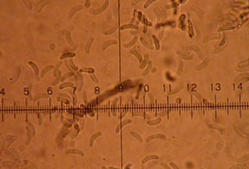 macrostoma