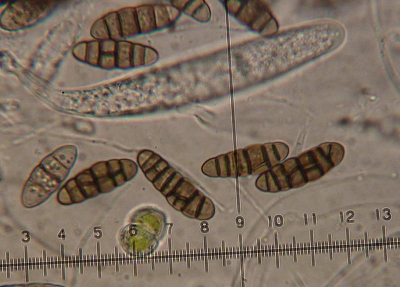 macrostoma