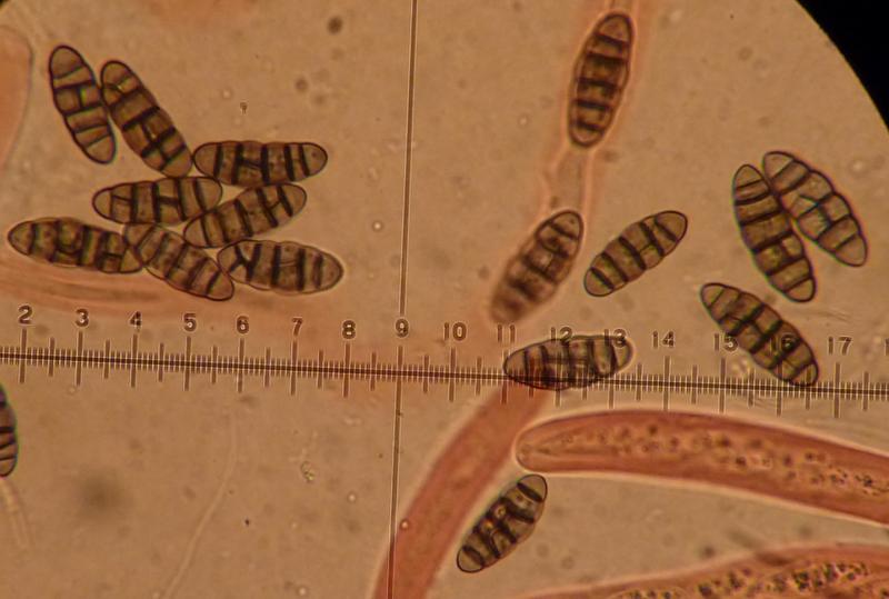 macrostoma
