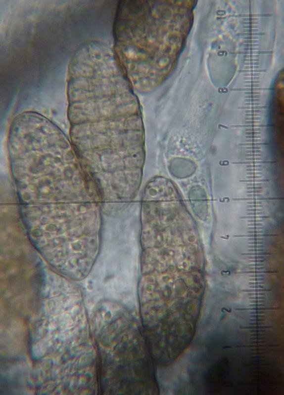 macrostoma