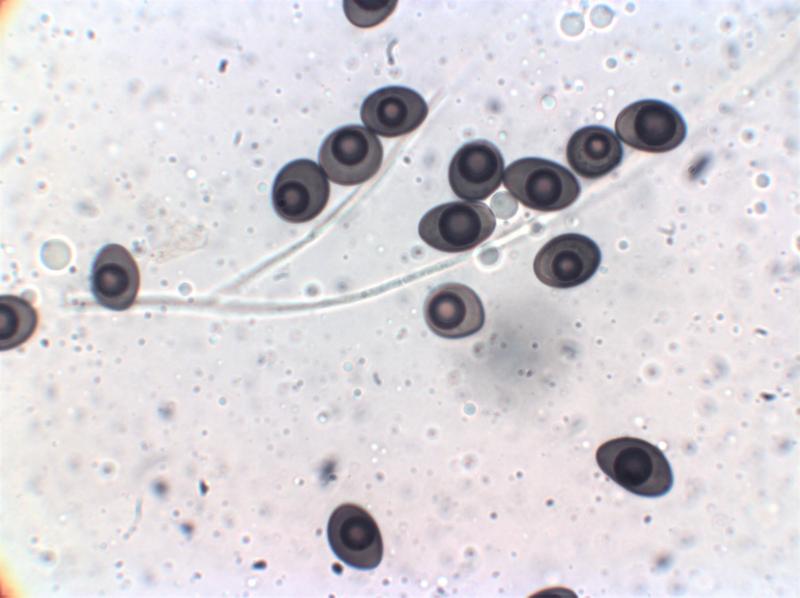 macrostoma