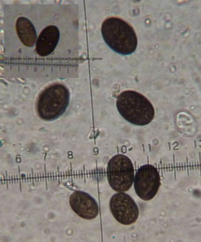 macrostoma