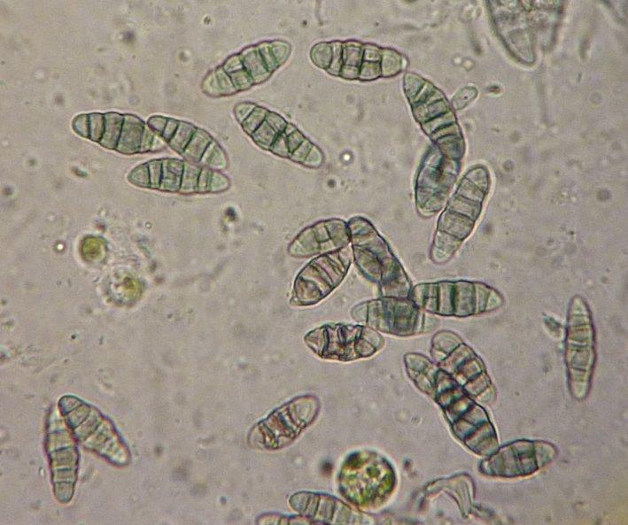 macrostoma