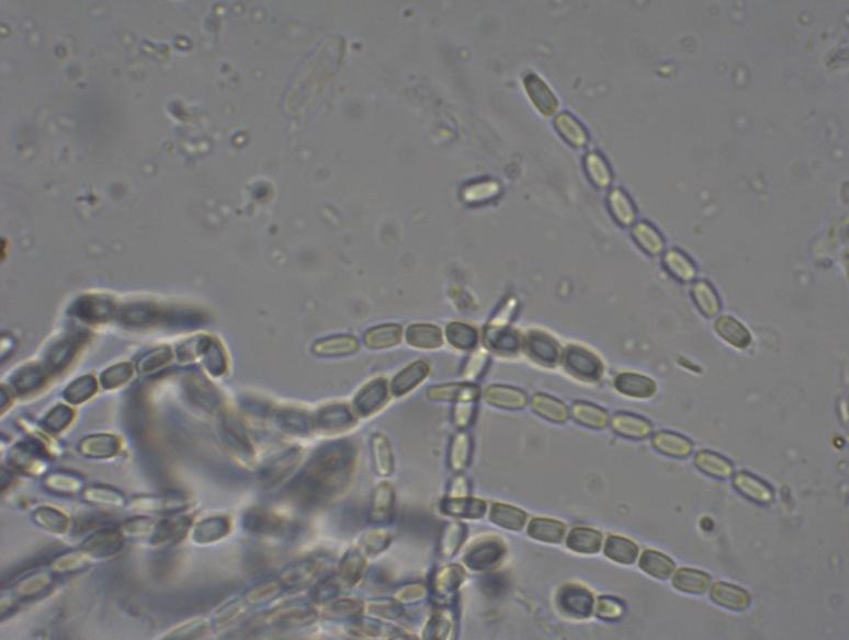 macrostoma