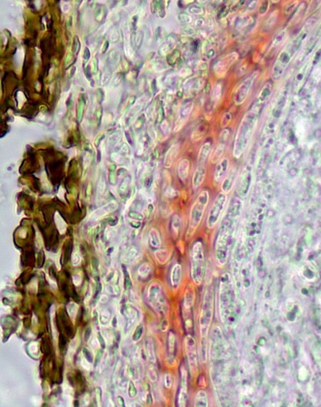 macrostoma