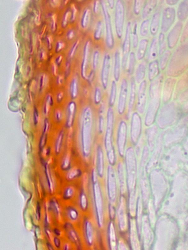 macrostoma