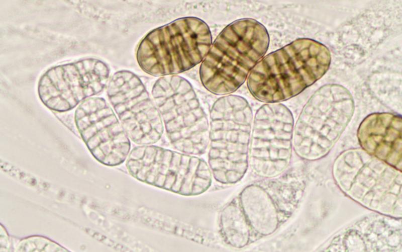 macrostoma