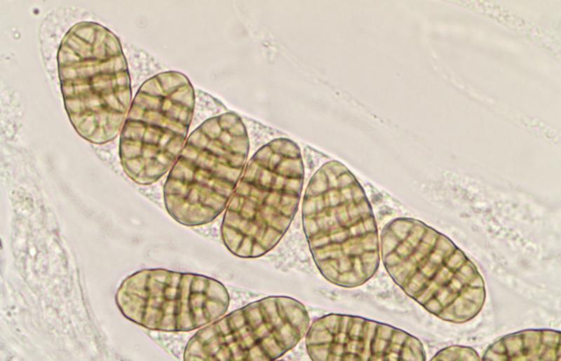 macrostoma