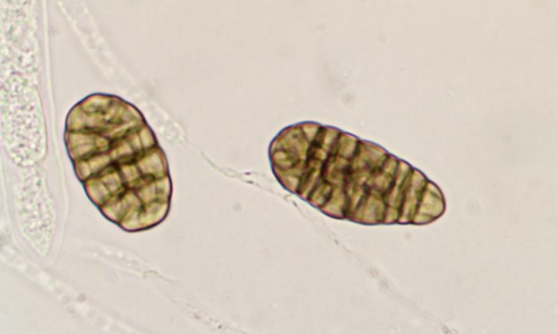 macrostoma