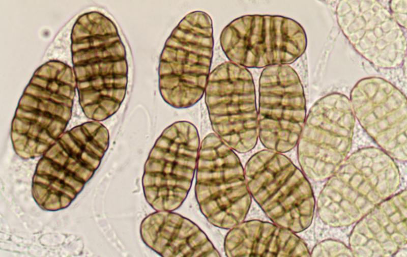 macrostoma