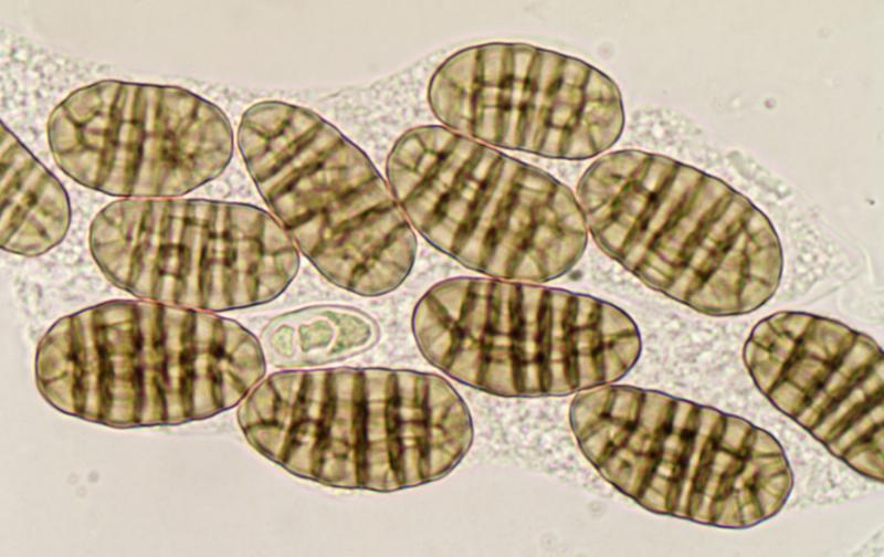 macrostoma
