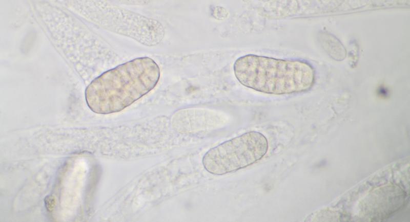 macrostoma