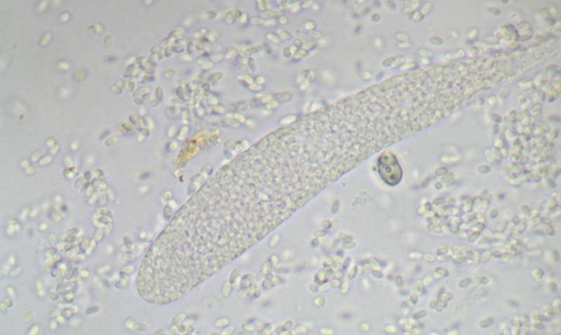 macrostoma