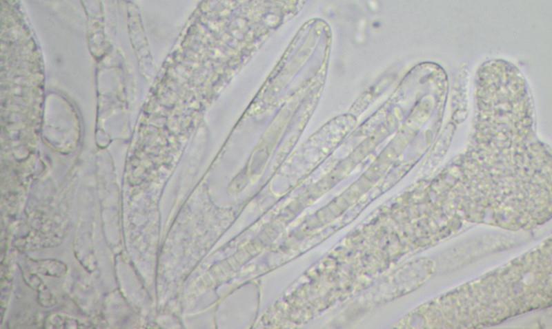 macrostoma