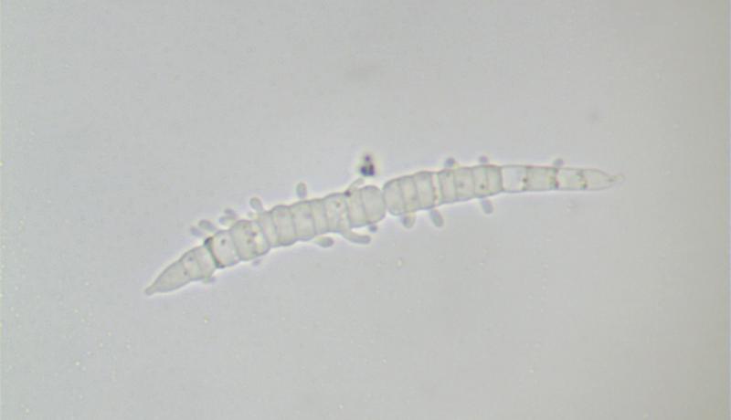 macrostoma