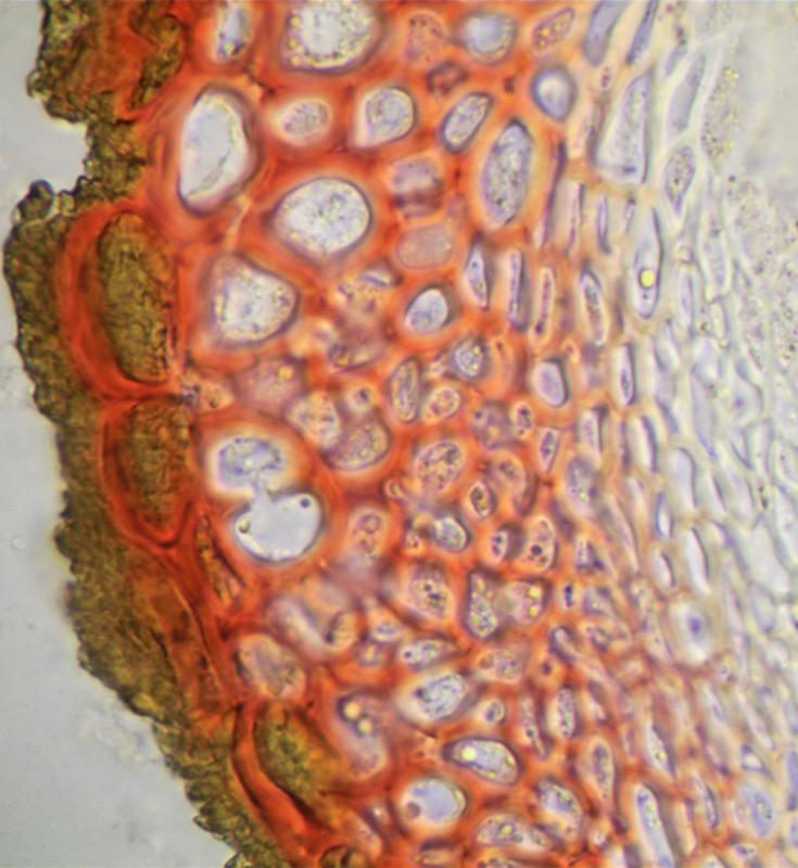 macrostoma