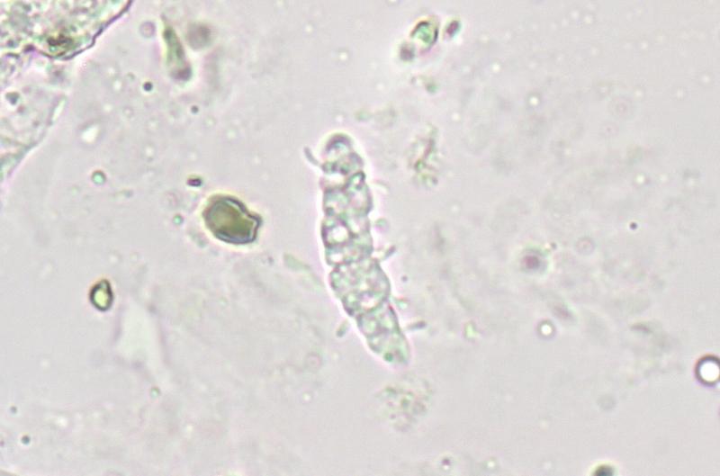 macrostoma