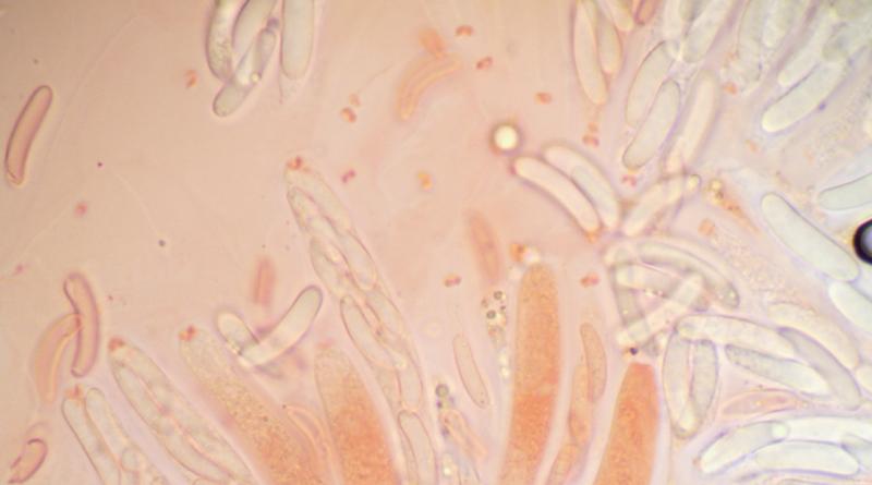 macrostoma