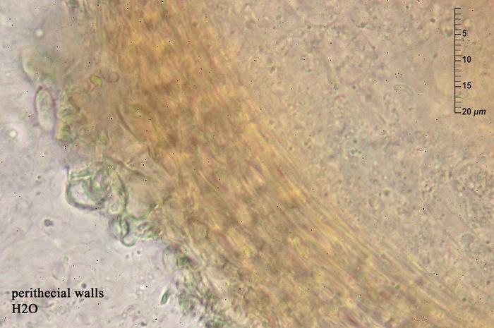 macrostoma
