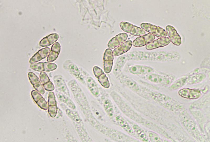 macrostoma